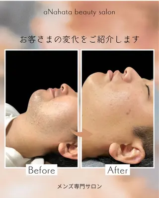 メンズ aNahata beauty salon所属・田中 菜月のエステ・リラクイメージ