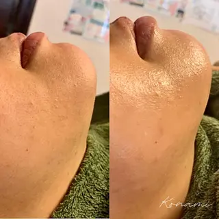 シードリン 府内店 小波のエステ・リラクイメージ