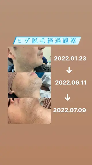 メンズ トータルビューティー サロンCherie2のエステ・リラクイメージ