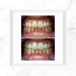 ホワイトニングサロンLUMIÉRE所属・ホワイトニングサロン LUMIÉREのその他イメージ