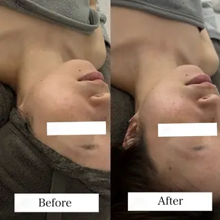 Linoas所属・kogao&head Linoasのエステ・リラクイメージ