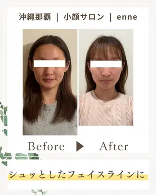小顔サロンenne所属・小顔サロンenne 【エンネ】のその他イメージ