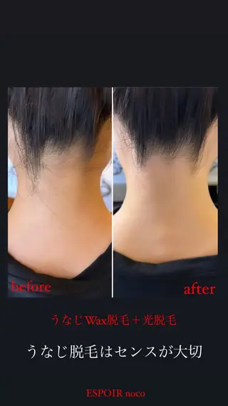 ワックス脱毛🌈 ESPOIRnocoのエステ・リラクイメージ