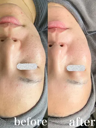 a.spa＆herb所属・a.spa&herb 船橋北口店のエステ・リラクイメージ