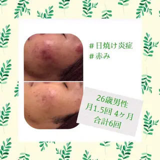 ミディアム カラー パーマ ヘアアレンジ メンズ キッズ ネイル マツエク・マツパ ニキビ・肌質改善専門 ♡人生が変わるサロンのエステ・リラクイメージ