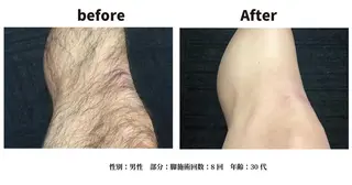 Butterfly 津田沼店　松井のエステ・リラクイメージ