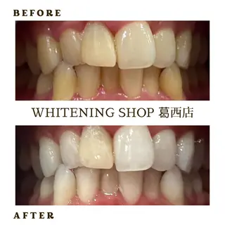 メンズ ホワイトニング ショップ葛西店のその他イメージ