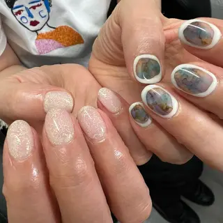 ネイル MAHINA nail所属・MAHINA/ネイル 巻き爪矯正/角質ケアのネイルデザイン