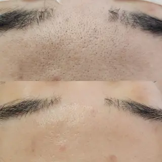 Anacia Beauty Salon所属・美肌脱毛&毛穴専門 Anaciaのエステ・リラクイメージ