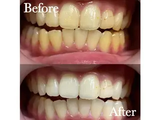 LBSホワイトニング 🌐渋谷店 公式のエステ・リラクイメージ