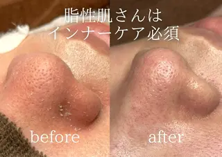 Peerless所属・chi kaのエステ・リラクイメージ