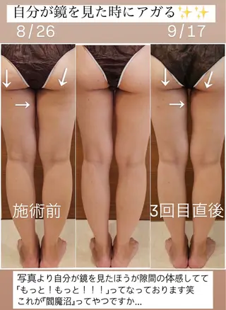 Chio-RE所属・Wax/絹肌艶肌🌼 坂結加のエステ・リラクイメージ