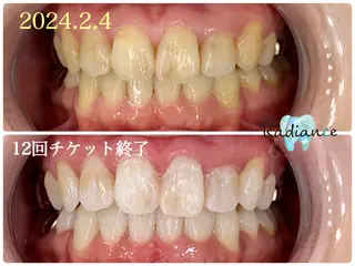札幌ホワイトニング ラディアンス札幌駅店のその他イメージ