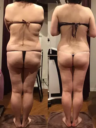 espresso,所属・《痩身、小顔専門店》 エスプレッソのエステ・リラクイメージ