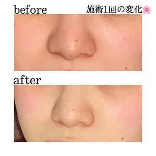 触れたくなる モテ肌へ...❤︎のエステ・リラクイメージ