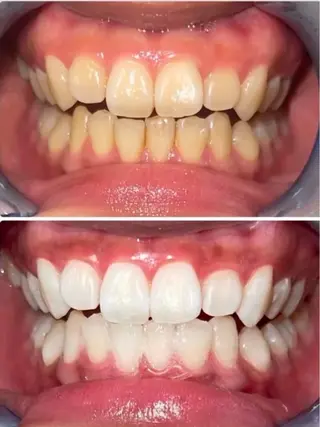 セルフホワイトニングサロンエクシアホワイト倉敷店所属・ecxiawhite 倉敷店のエステ・リラクイメージ