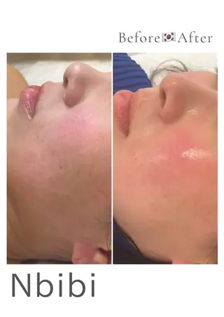 韓国🇰🇷価格 サロン_Nbibiのエステ・リラクイメージ