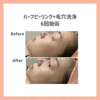 ハーブピーリング専門 muro.のエステ・リラクイメージ