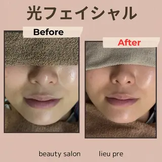 lieupré 脱毛 oshima‎⌣̈のエステ・リラクイメージ