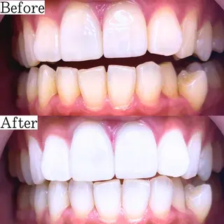 LBSホワイトニング 銀座店💎公式のその他イメージ