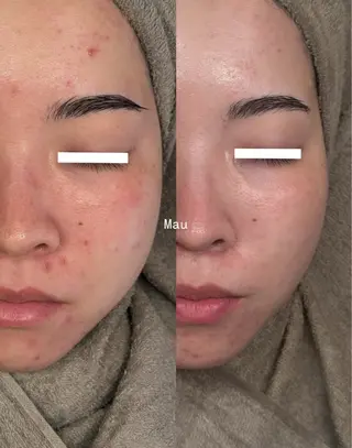 Mau beauty salon所属・Mau (マウ)のエステ・リラクイメージ