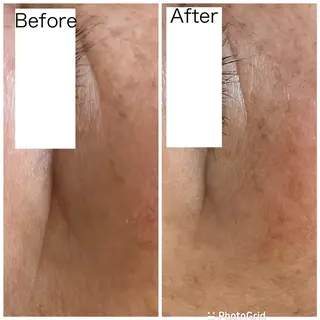 エイジングケア専門 Ponolaのエステ・リラクイメージ