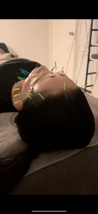 美容鍼×小顔矯正 ×美容整体　浜川泰仁のエステ・リラクイメージ