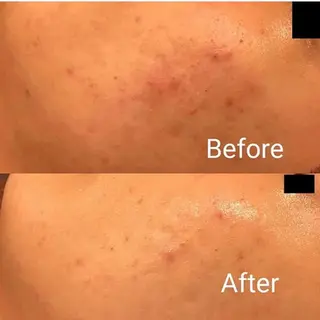 サロンドゥ ルシエルのエステ・リラクイメージ