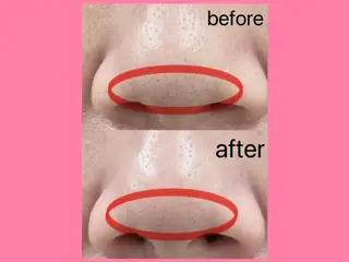 肌ケア＆毛穴洗浄 Cheriのエステ・リラクイメージ