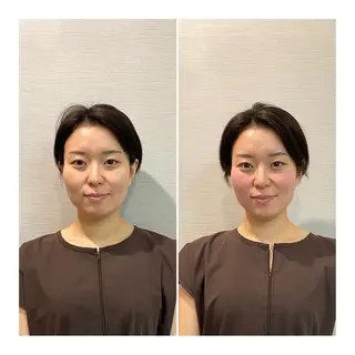 即小顔♥️美容鍼× ハーブピーリングのその他イメージ