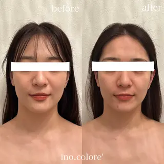 エステサロンino.colore'所属・小顔サロン ino.coloreのエステ・リラクイメージ
