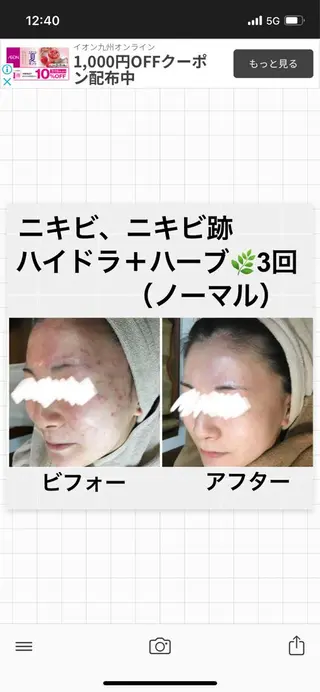 ロング カラー パーマ ヘアアレンジ メンズ キッズ ネイル マツエク・マツパ アイブロウ ハーブピーリング専門 🌿モッカのエステ・リラクイメージ