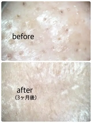 メナードフェイシャルサロン岐阜桜通所属・大橋 あつこのエステ・リラクイメージ