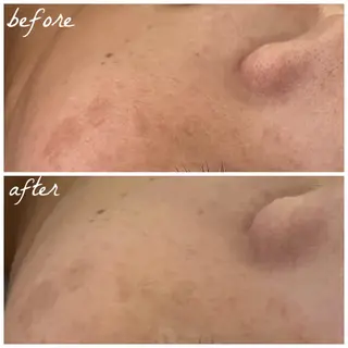 メンズ メナード岐阜茜部 杉浦のエステ・リラクイメージ