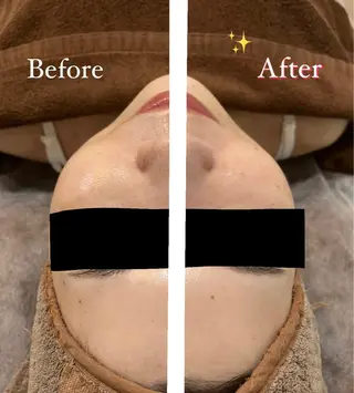 脱毛サロン fam.豊澤柚良のエステ・リラクイメージ