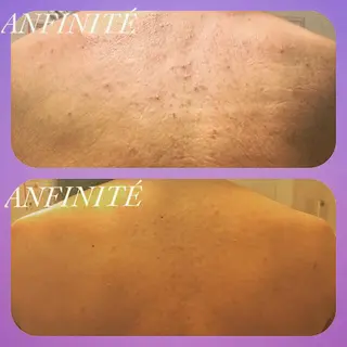 ANFINITÉ所属・ANFINITÉ アンフィニテのエステ・リラクイメージ