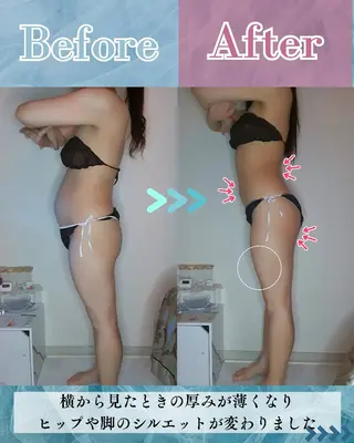 痩身ハーブピーリング 筋膜リリース☆B&Hのエステ・リラクイメージ