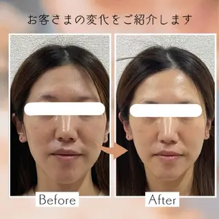 小顔矯正＆美肌サロン ブプラ大元駅前店のエステ・リラクイメージ