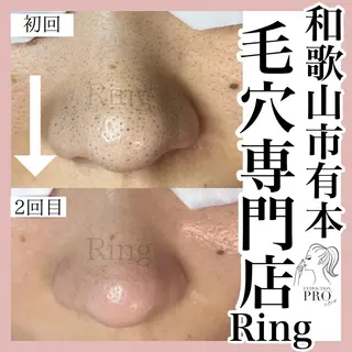 和歌山　毛穴専門店 Ringのエステ・リラクイメージ