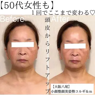 リフトアップ小顔 専門のエステ・リラクイメージ