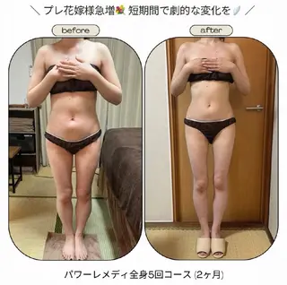 biloop所属・《痩身×疲労改善》 BILOOPのエステ・リラクイメージ