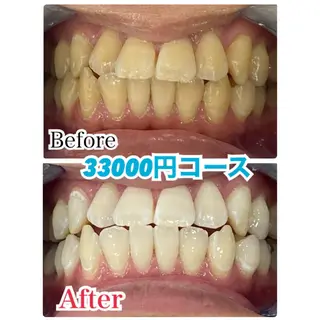 ショート ヘアアレンジ キッズ ネイル マツエク・マツパ プラチナムビューティー柏所属・【歯科提携】柏ホワイ トニングスタイルのその他イメージ