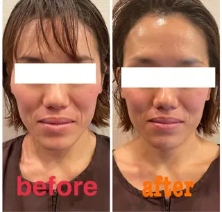 美容鍼灸サロン mahoroba院長のエステ・リラクイメージ