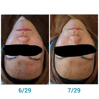 セミロング カラー パーマ ヘアアレンジ メンズ キッズ ネイル マツエク・マツパ 肌質体質を変えて すっぴん肌にのエステ・リラクイメージ