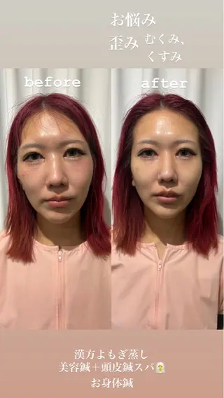 美容鍼灸サロン mahoroba院長のエステ・リラクイメージ