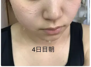 エステティック RAYVIS池袋🐱のエステ・リラクイメージ