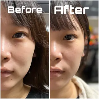 【敏感肌管理×小顔サロン】Belle orchid所属・敏感肌×小顔サロン 玲央奈のエステ・リラクイメージ