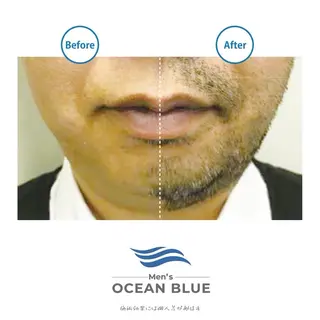 メンズ メンズオーシャンブルー福岡店所属・柿添 希実のエステ・リラクイメージ