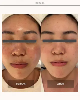 mine.mマインエム所属・mine.mi マインエムのエステ・リラクイメージ