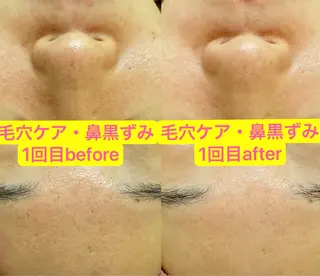 エレガンテ　ビューティーサロン所属・🎀エレガンテ🎀 美肌専門👸本間のその他イメージ